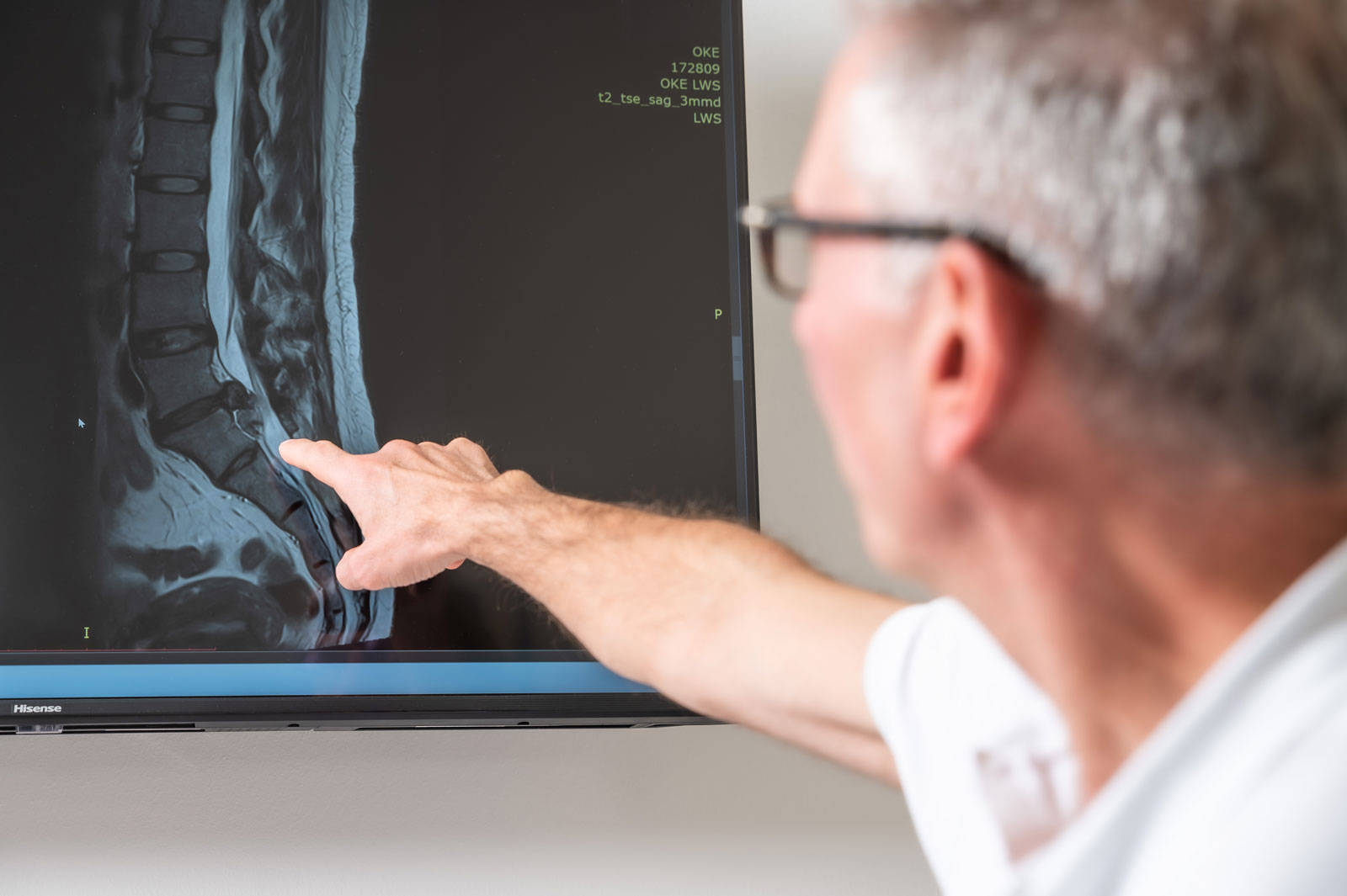 Befundung eines Röntgenbildes bei akuten Schmerzen in der Praxis Ortho Medis Dietz in Erlangen